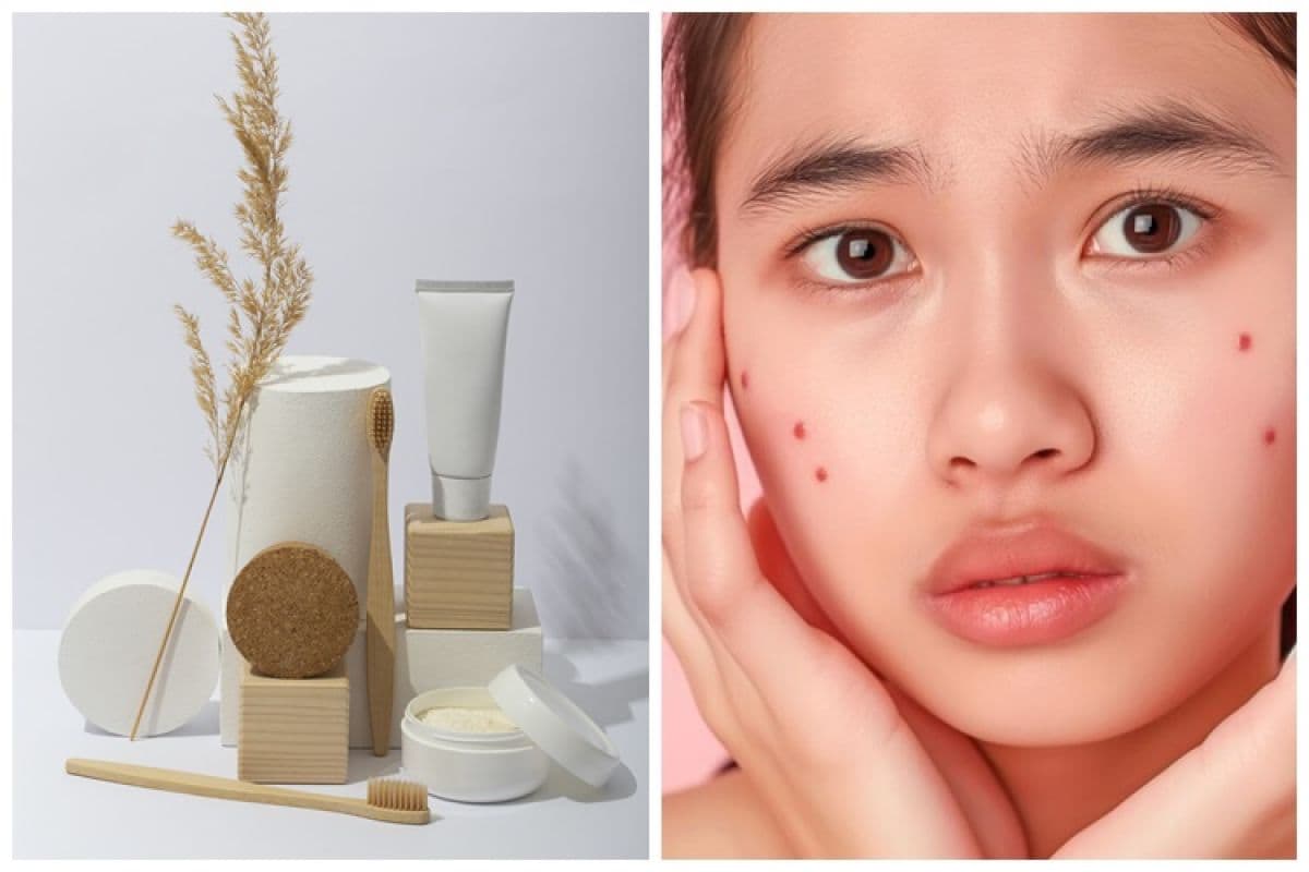 Bahaya Skincare Merkuri untuk Kulit yang Perlu Diketahui