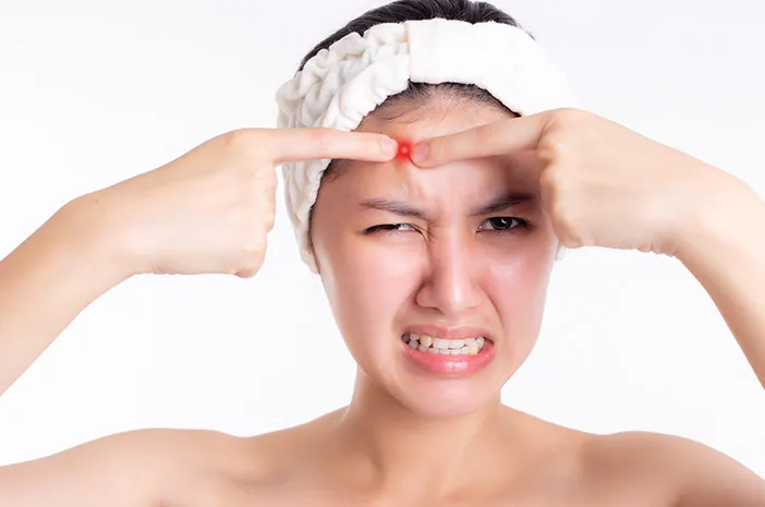 Jerawat di Dahi: Penyebab dan Cara Mengatasinya Jerawat di Dahi: Penyebab dan Cara Mengatasinya